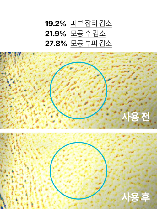 이니스프리 레티놀 시카 흔적 앰플 30ml